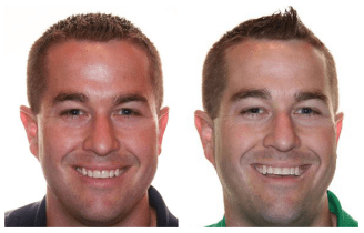 Before and After Treatment3